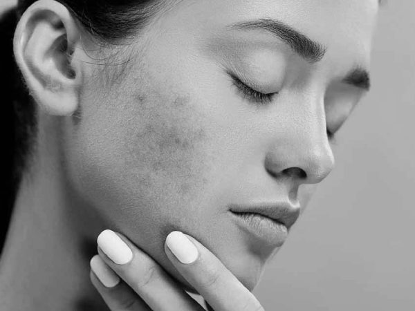 ayurveda treatment in dubai